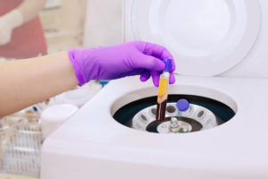 A physician extracting platelet-rich plasma through a test tube for a patient's therapy.