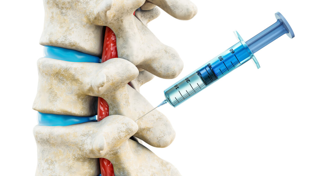 Facet joint injection for backbone injury or pain