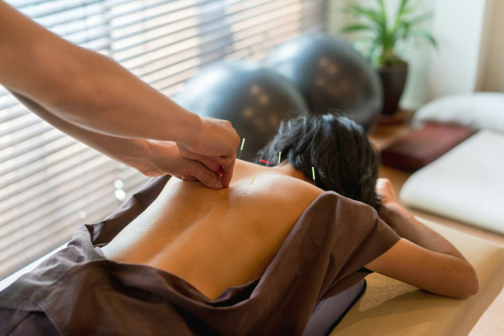 Woman at the acupuncturist